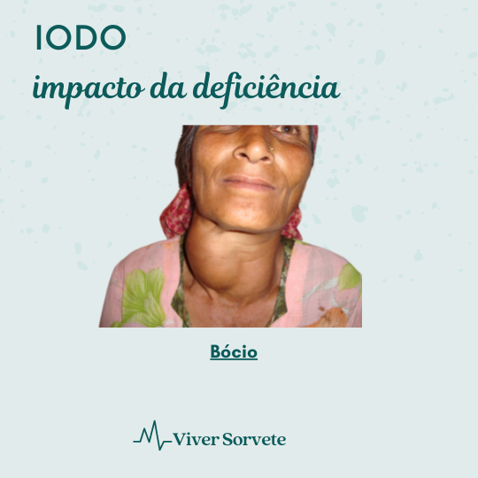  Sorvete, sorveteria, gelato, soft, açaí, consultoria de alimentos, consultoria sorvetes, rotulagem de sorvete, gelados comestíveis, alimentos, saúde pública, iodo